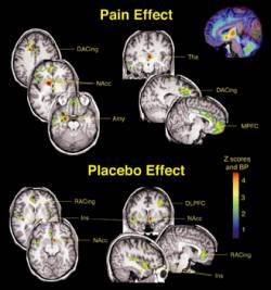 placebo.jpg