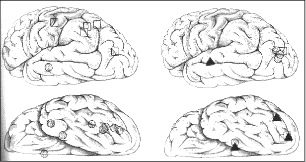 cerebrovisual1.gif