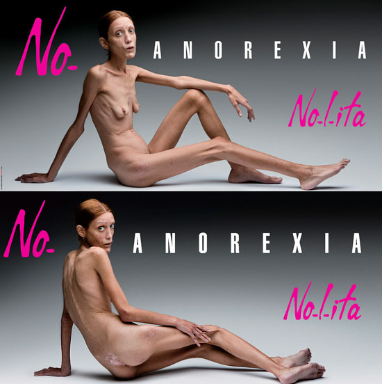 Toscani_anorexia_01 Toscani_anorexia_01