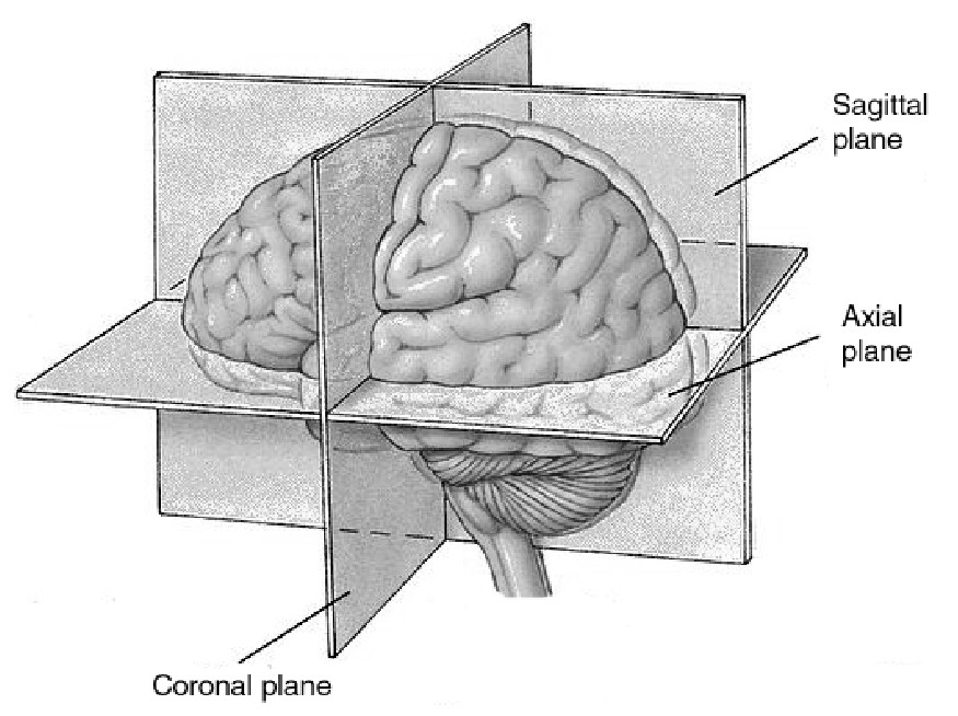 3dimensionescerebro