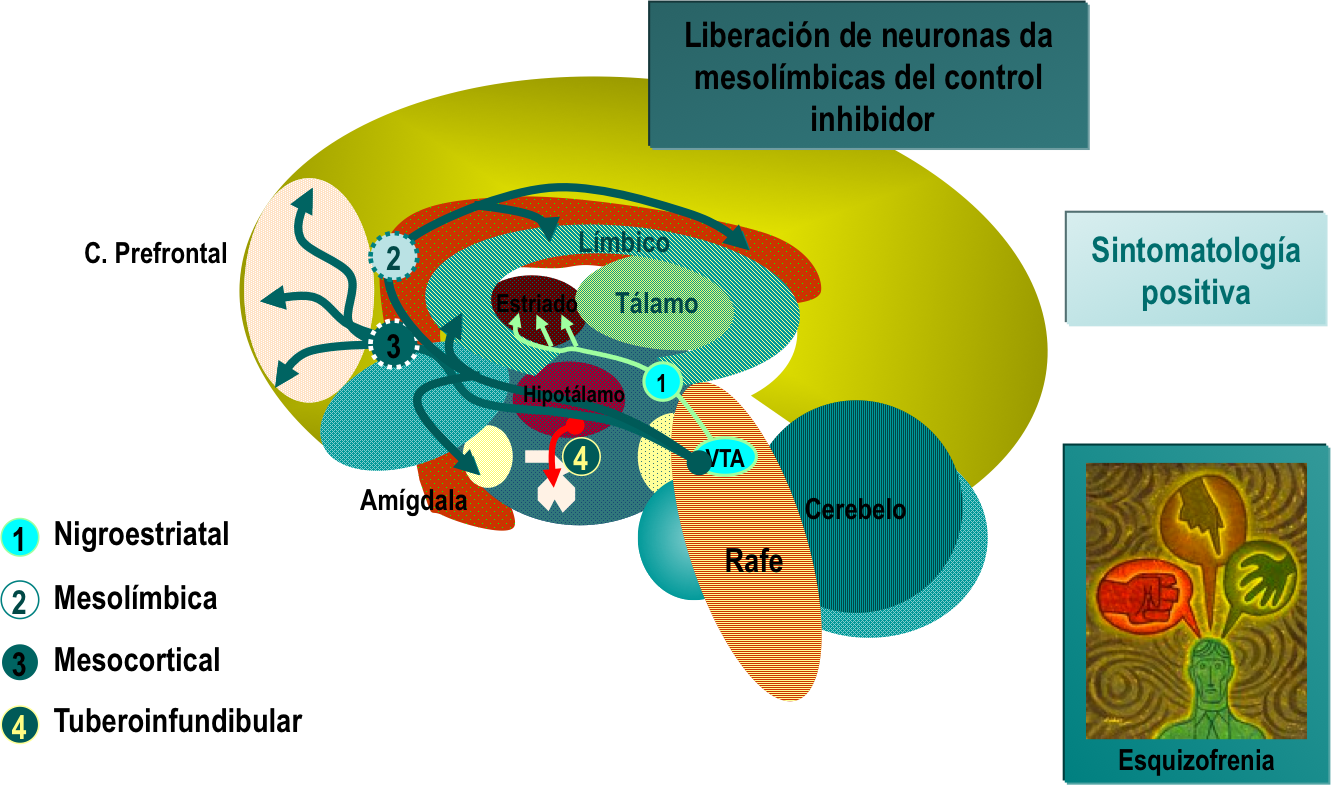 esquizofrenia